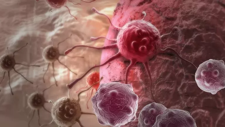 Cáncer3