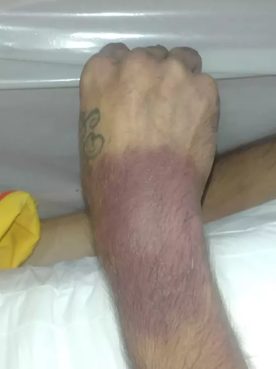 Erik 03