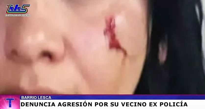 Violencia Barrio Lesca_2