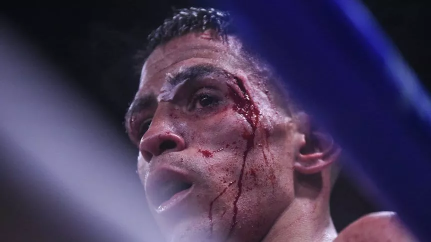 leandroblanc-juniorzarate-peleabdp10_862x485