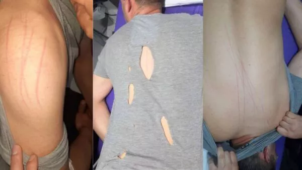 Ente maligno ataca a policía