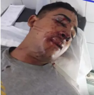 golpeado