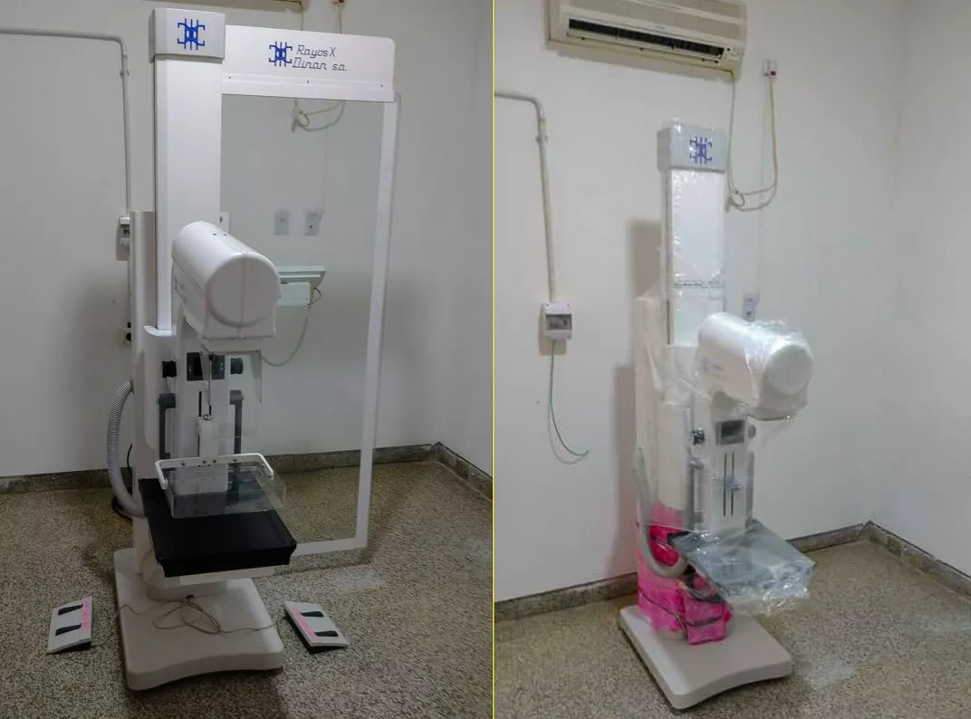 Nuevos mamógrafos