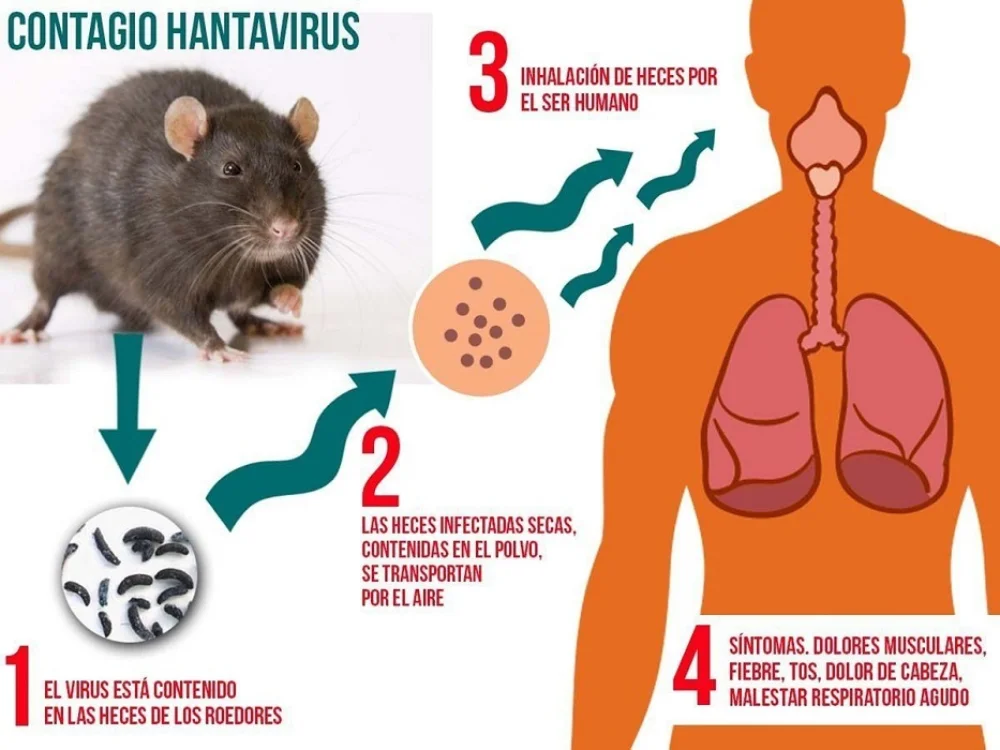 hantavirus-1-1
