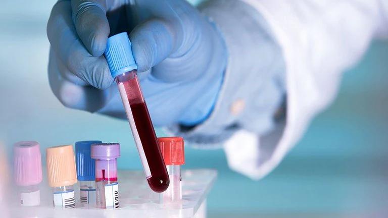 Prueba de sangre