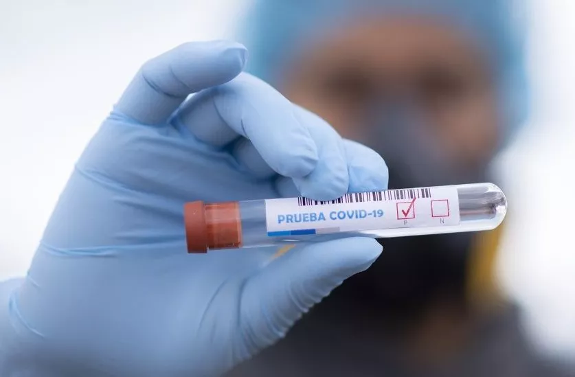 COVID 19, Coronavirus