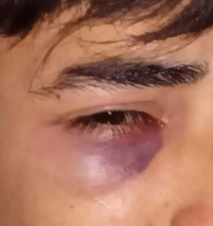 Menor golpeado
