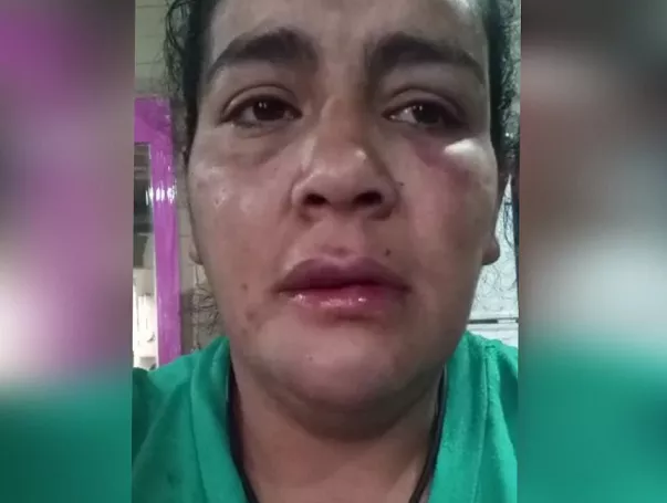 Flavia,  víctima de violencia de género