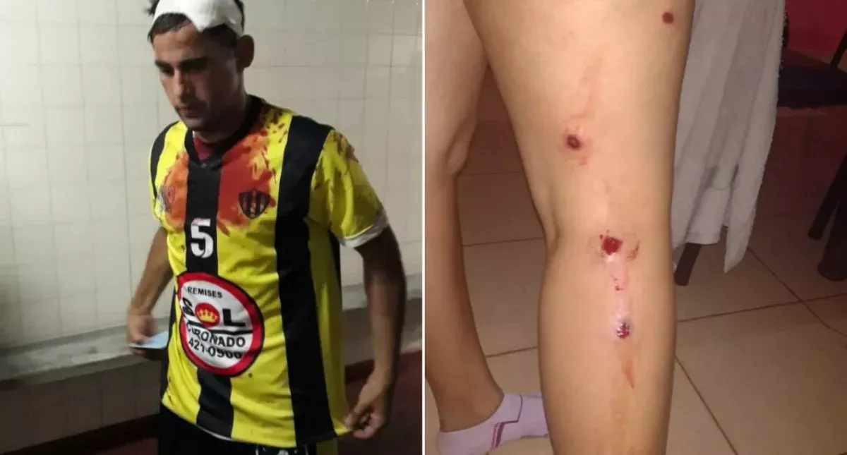Violento incidente en el futbol local