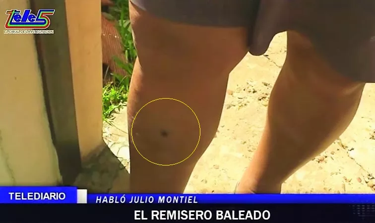 Remisero baleado