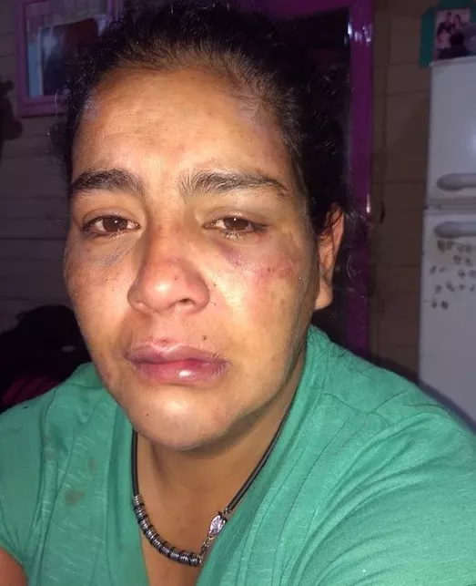 Víctima de violencia de género