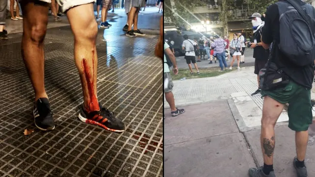 represion-periodistas-camarografos-reporteros-graficos-heridosjpg