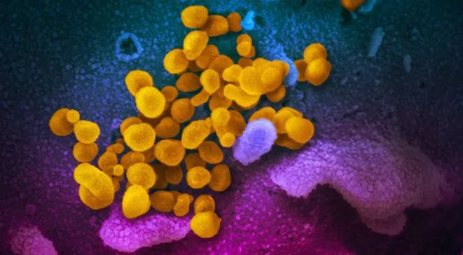 coronavirus