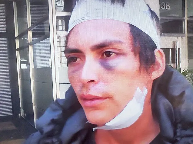 golpeado