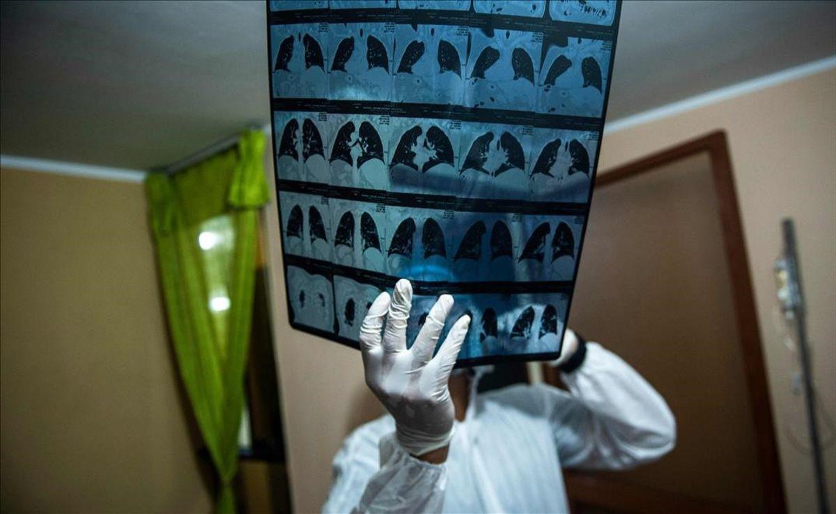 radiografia